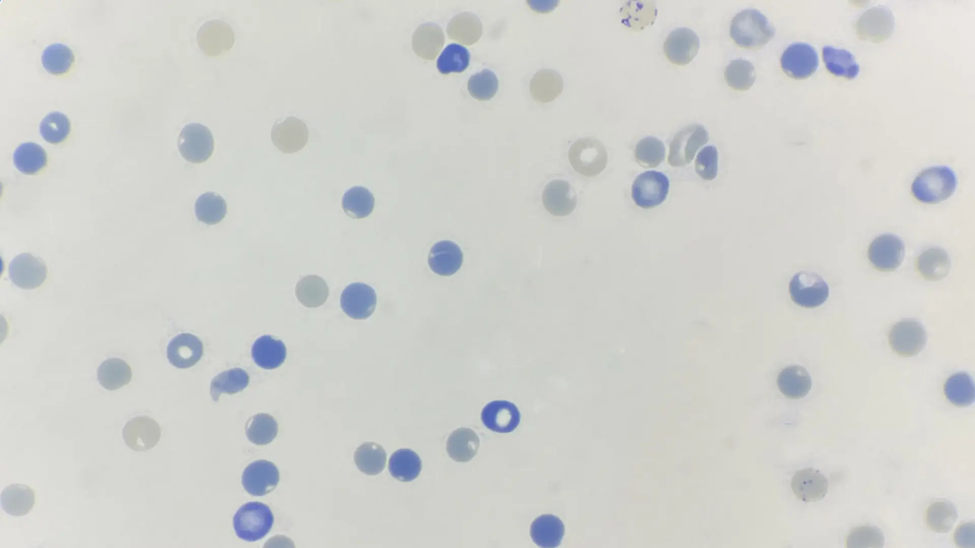 Manual Reticulocyte Count | Lab Reports Aid